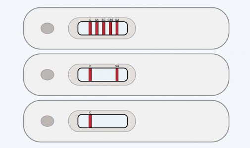 Scheme showing a multiplex immunochromatographic test for the simultaneous identification of Staphylococcus aureus (SA), Escherichia coli (EC), Streptococcus agalactiae (GBS) and Streptococcus uberis (SU). Legend: A – positive test for each test species, B – positive test for Streptococcus uberis, C – stamen confirming correct test performance.