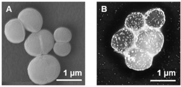 1 Typowy wynik obserwacji bakterii (A) oraz bakterii z naniesionymi nanocząstkami (B).